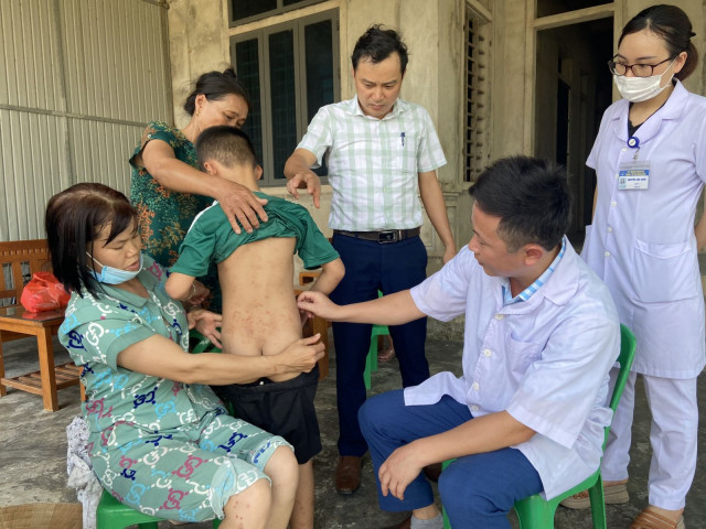 Khẩn trương làm rõ nguyên nhân hàng loạt người dân bị viêm da dị ứng do côn trùng đốt tại thôn Phúc Thanh, xã Thạch Khê, huyện Thạch Hà