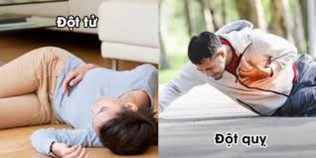 Bác sĩ chỉ cách phân biệt đột quỵ và đột tử để sơ cứu đúng cách
