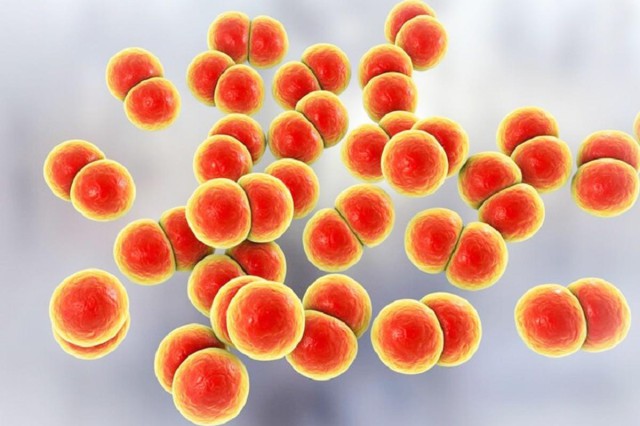 Cảnh giác với những diễn biến nguy hiểm của bệnh não mô cầu